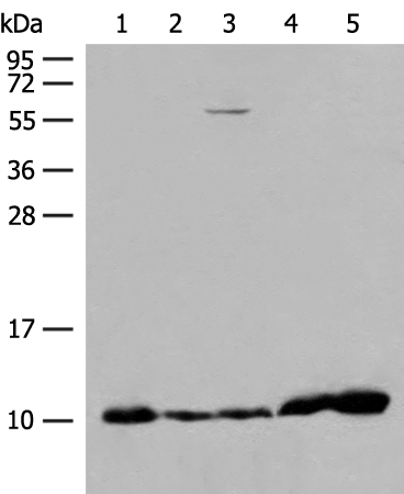 Anti-ATP5ME Rabbit Polyclonal Antibody
