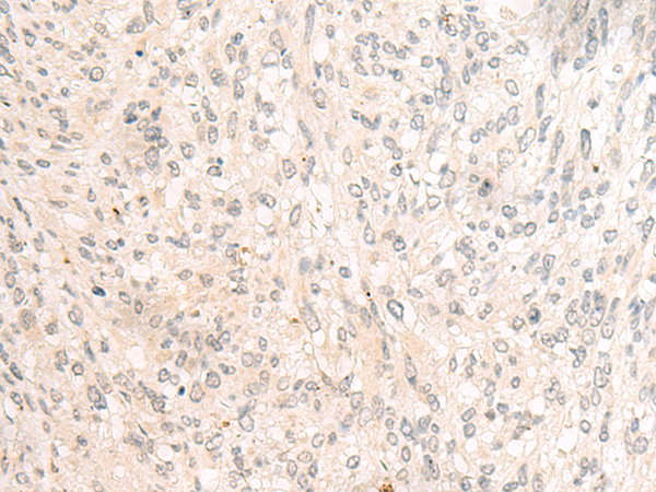Anti-HBB Rabbit Polyclonal Antibody