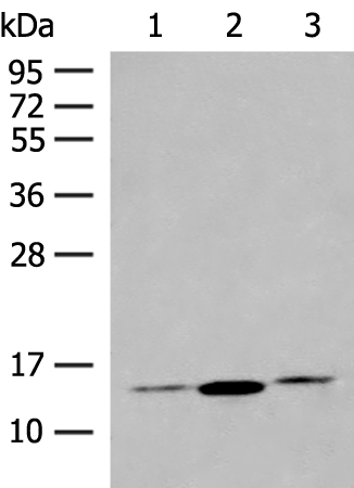 Anti-HBB Rabbit Polyclonal Antibody