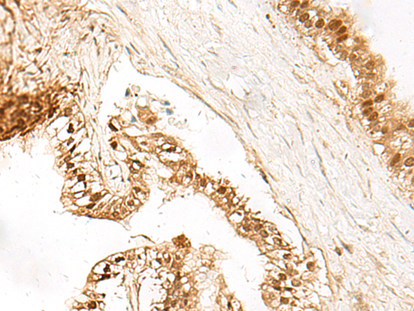 Anti-Lactate Dehydrogenase A Rabbit Polyclonal Antibody
