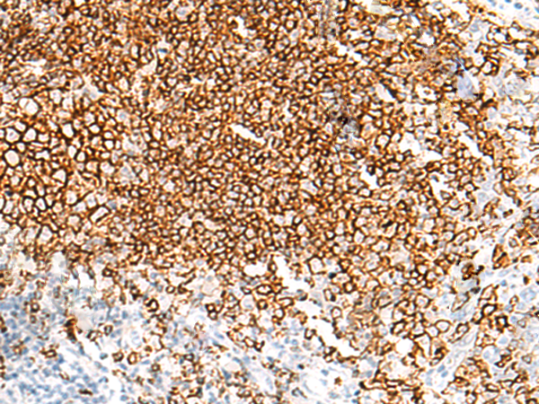 Anti-MS4A1 Rabbit Polyclonal Antibody