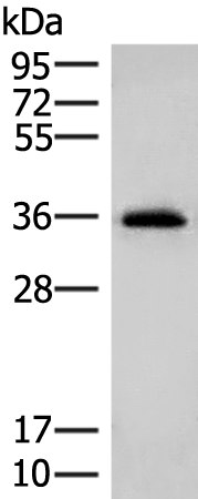 Anti-MS4A1 Rabbit Polyclonal Antibody