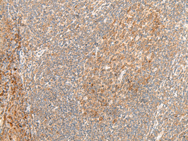 Anti-GPR62 Rabbit Polyclonal Antibody