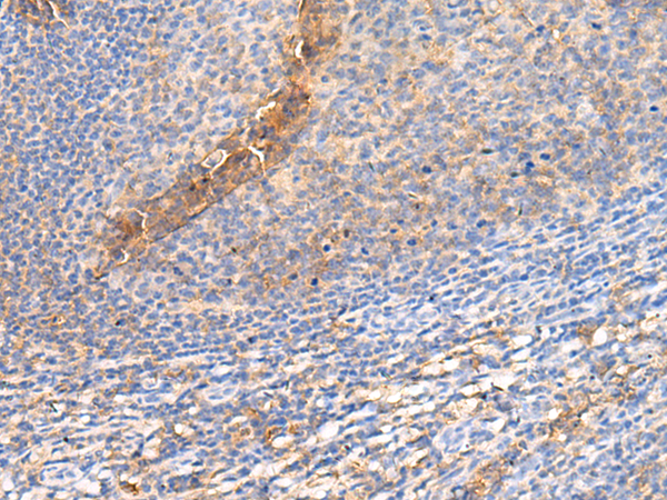 Anti-GPR142 Rabbit Polyclonal Antibody