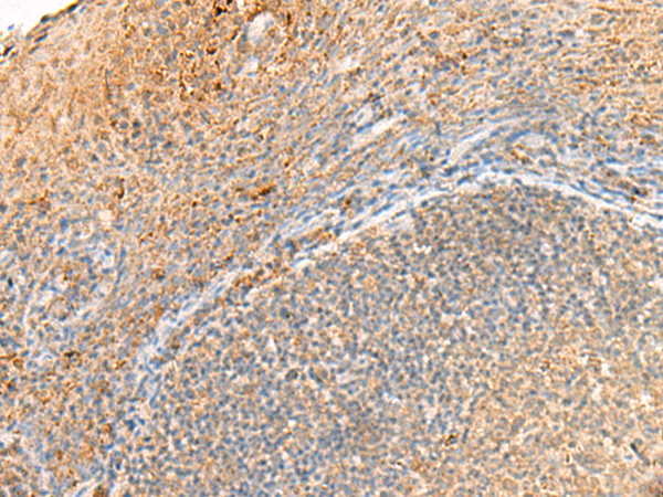 Anti-GPR161 Rabbit Polyclonal Antibody