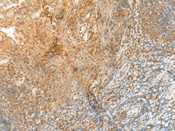 Anti-GPR89A/GPR89B Rabbit Polyclonal Antibody