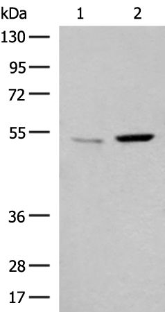 Anti-GPR89A/GPR89B Rabbit Polyclonal Antibody