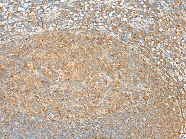 Anti-GRHPR Rabbit Polyclonal Antibody