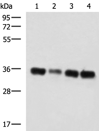 Anti-GRHPR Rabbit Polyclonal Antibody