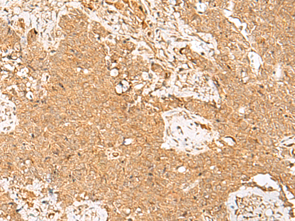 Anti-GSTM2 Rabbit Polyclonal Antibody