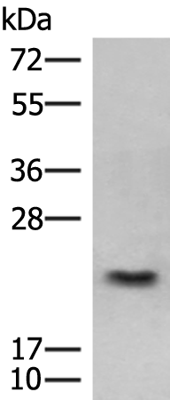 Anti-GSTM2 Rabbit Polyclonal Antibody