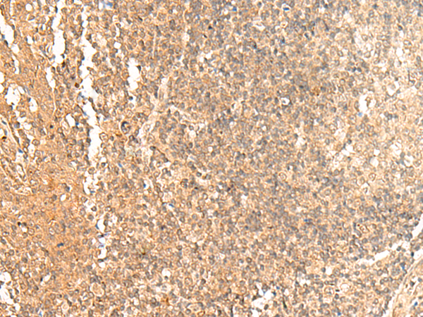 Anti-GTF3A Rabbit Polyclonal Antibody