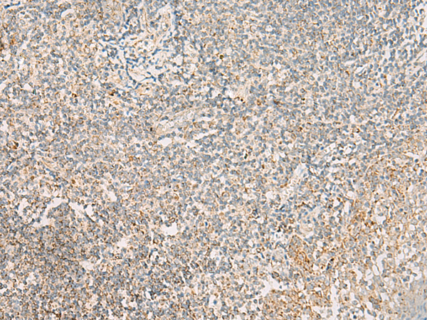 Anti-HADH Rabbit Polyclonal Antibody