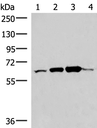 Anti-ZNF85 Rabbit Polyclonal Antibody
