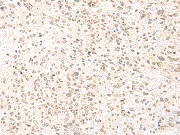 Anti-SNRPG Rabbit Polyclonal Antibody