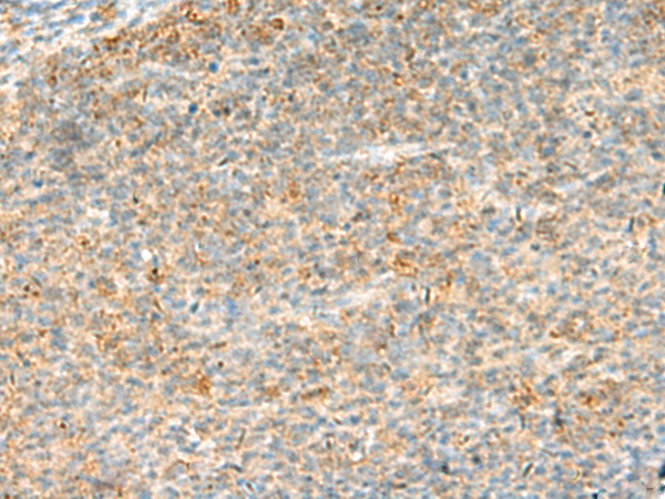 Anti-HELT Rabbit Polyclonal Antibody