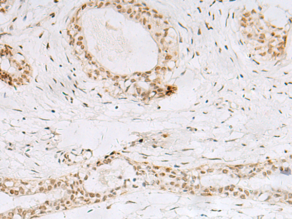 Anti-hnRNP A1L2 Rabbit Polyclonal Antibody
