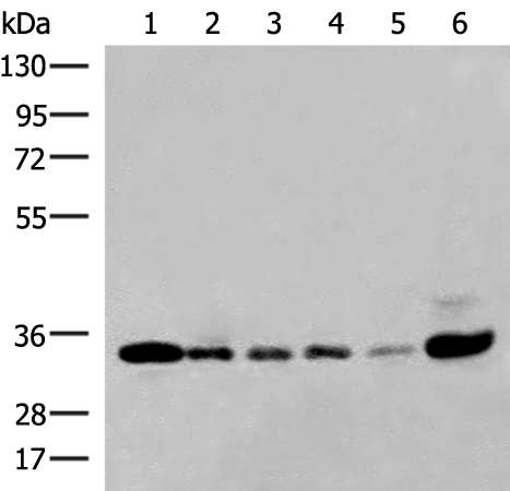 Anti-hnRNP A1L2 Rabbit Polyclonal Antibody