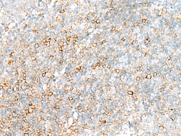 Anti-HLA DRB3 Rabbit Polyclonal Antibody