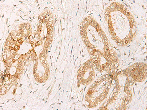 Anti-HNF 6 Rabbit Polyclonal Antibody