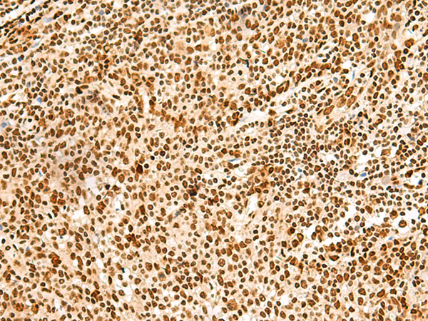 Anti-hnRNP A3 Rabbit Polyclonal Antibody
