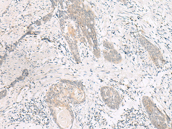 Anti-HOOK3 Rabbit Polyclonal Antibody
