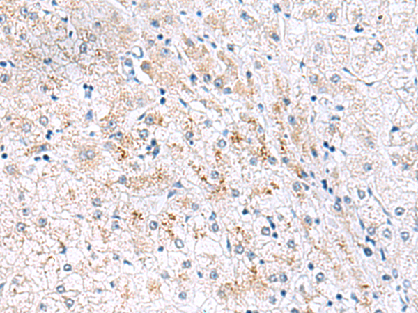 Anti-HPS6 Rabbit Polyclonal Antibody