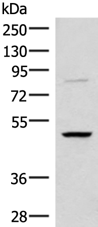Anti-RRP8 Rabbit Polyclonal Antibody