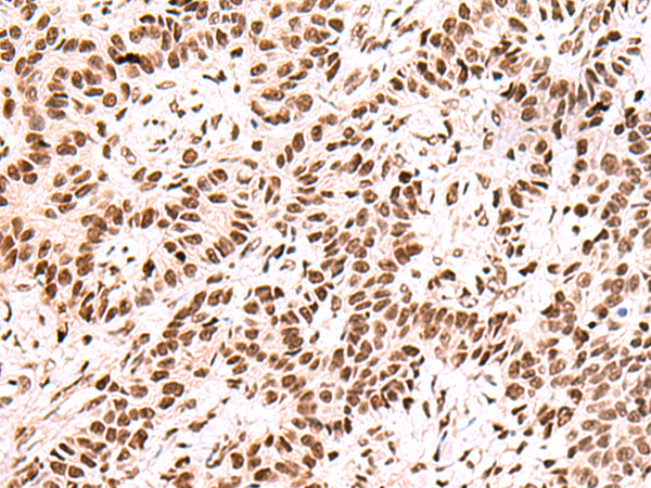 Anti-FOXK2 Rabbit Polyclonal Antibody
