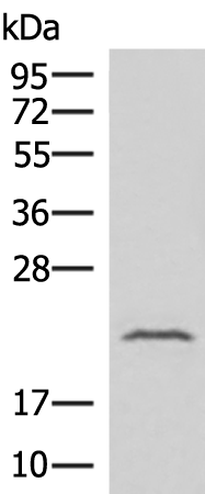 Anti-Interferon alpha 8 Rabbit Polyclonal Antibody