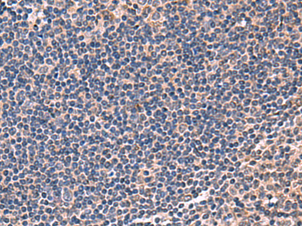 Anti-IPPK Rabbit Polyclonal Antibody