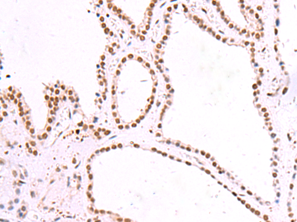 Anti-IRF2BP2 Rabbit Polyclonal Antibody