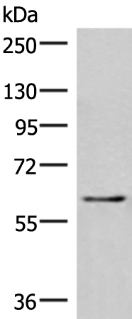 Anti-IRF2BP2 Rabbit Polyclonal Antibody