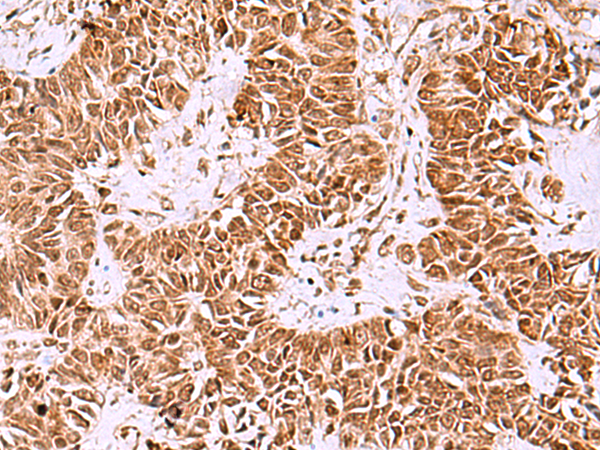Anti-IRX1 Rabbit Polyclonal Antibody