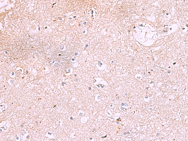 Anti-IRX2 Rabbit Polyclonal Antibody