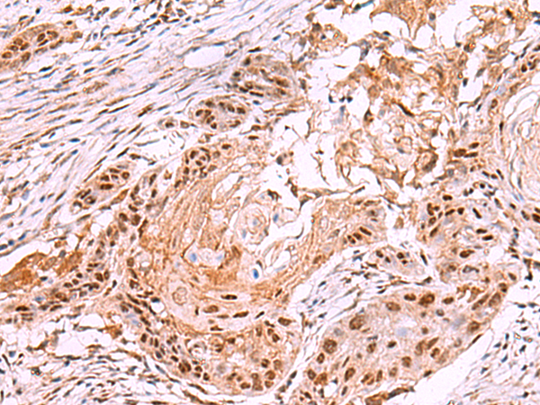 Anti-IRX4 Rabbit Polyclonal Antibody