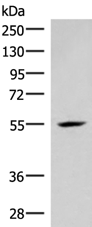 Anti-IRX4 Rabbit Polyclonal Antibody