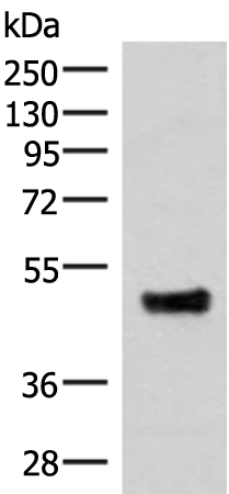 Anti-IRX5 Rabbit Polyclonal Antibody