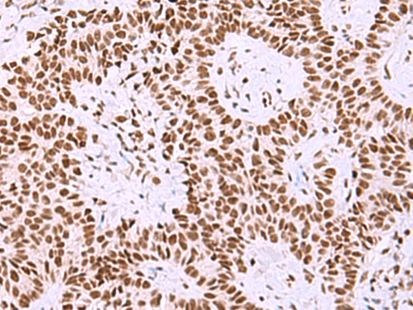 Anti-ISY1 Rabbit Polyclonal Antibody