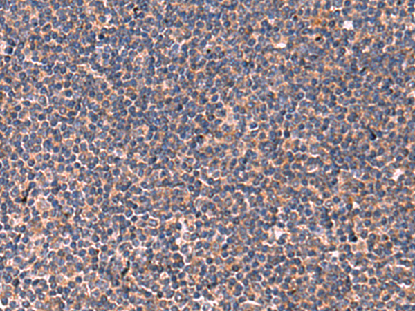 Anti-JAM3 Rabbit Polyclonal Antibody