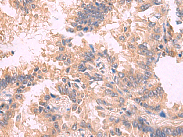 Anti-ZO-1 tight junction protein Rabbit Polyclonal Antibody