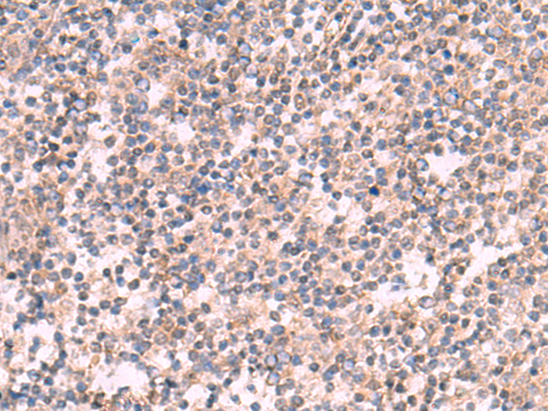 Anti-KCNK2 Rabbit Polyclonal Antibody