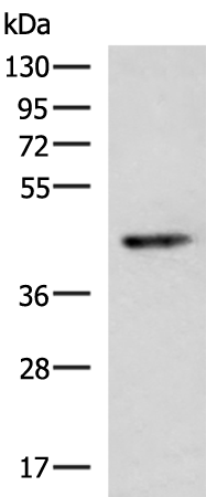 Anti-KCNK2 Rabbit Polyclonal Antibody