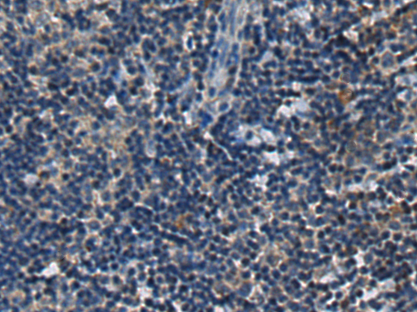 Anti-SPINK1 Rabbit Polyclonal Antibody