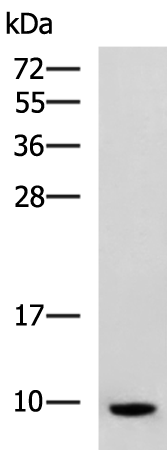 Anti-SPINK1 Rabbit Polyclonal Antibody