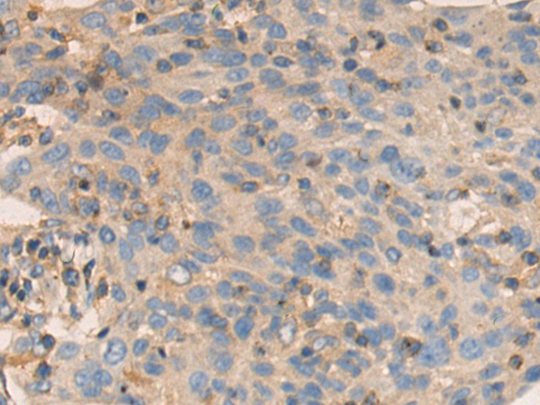 Anti-PKA C beta Rabbit Polyclonal Antibody