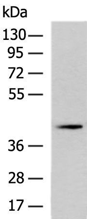 Anti-PKA C beta Rabbit Polyclonal Antibody