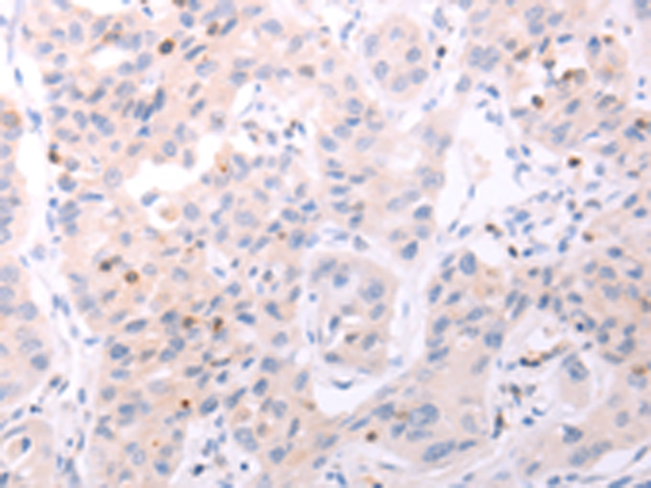 Anti-ACOT2 Rabbit Polyclonal Antibody