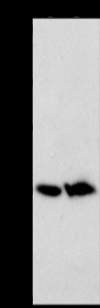 Anti-ACOT2 Rabbit Polyclonal Antibody