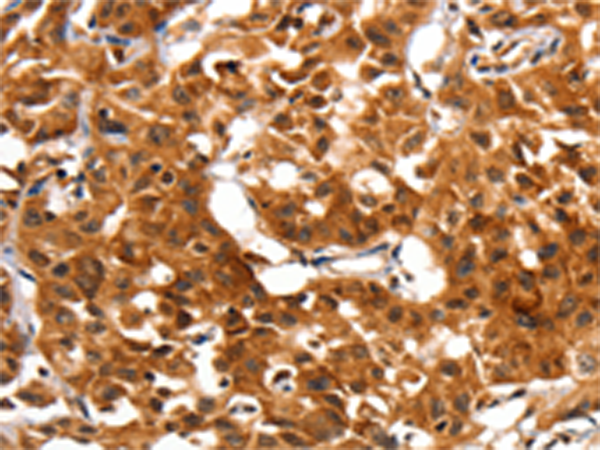 Anti-ADAP1 Rabbit Polyclonal Antibody